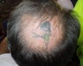 brzydki tatuaż na głowie